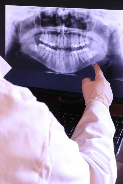 Best Emergency Root Canal Treatment in Algonac, MI