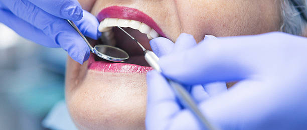 Best Emergency Dental Care for Broken or Chipped Teeth in Algonac, MI